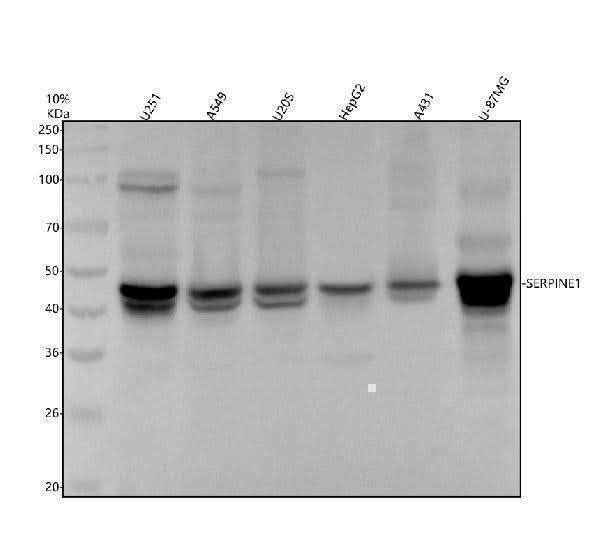 Anti-PAI1 Rabbit Monoclonal Antibody Boster Bio