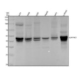 Anti-PAI1 Rabbit Monoclonal Antibody Boster Bio