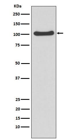 Anti-MVP Rabbit Monoclonal Antibody Boster Bio