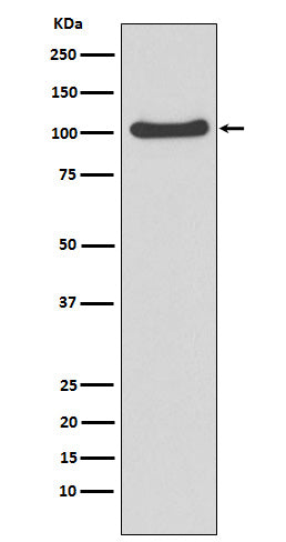 Anti-MVP Rabbit Monoclonal Antibody Boster Bio