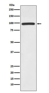 Anti-HMGCR/Hmg Coa Reductase Rabbit Monoclonal Antibody Boster Bio