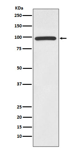 Anti-HMGCR/Hmg Coa Reductase Rabbit Monoclonal Antibody Boster Bio