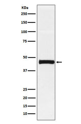 Anti-Pentraxin 3 Rabbit Monoclonal Antibody Boster Bio