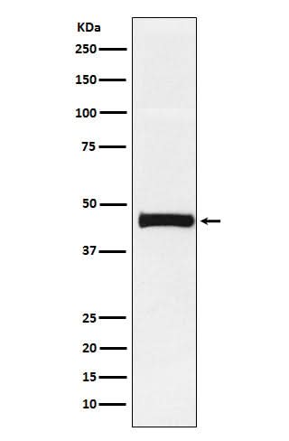 Anti-Pentraxin 3 Rabbit Monoclonal Antibody Boster Bio