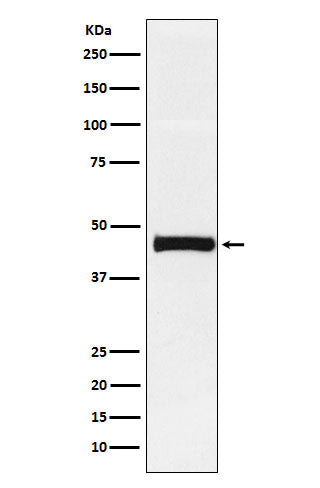 Anti-Pentraxin 3 Rabbit Monoclonal Antibody Boster Bio