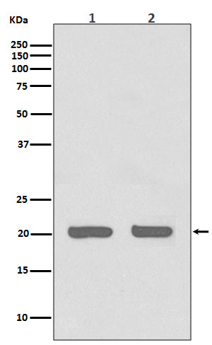 Anti-IL1RA Rabbit Monoclonal Antibody Boster Bio