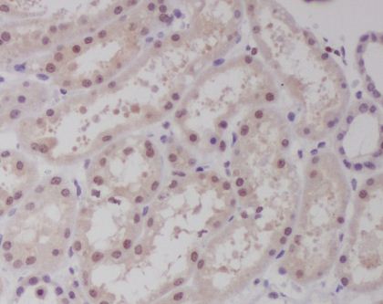 Anti-c-Maf Rabbit Monoclonal Antibody Boster Bio