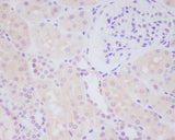 Anti-MMP14/Mt1 Mmp Rabbit Monoclonal Antibody Boster Bio