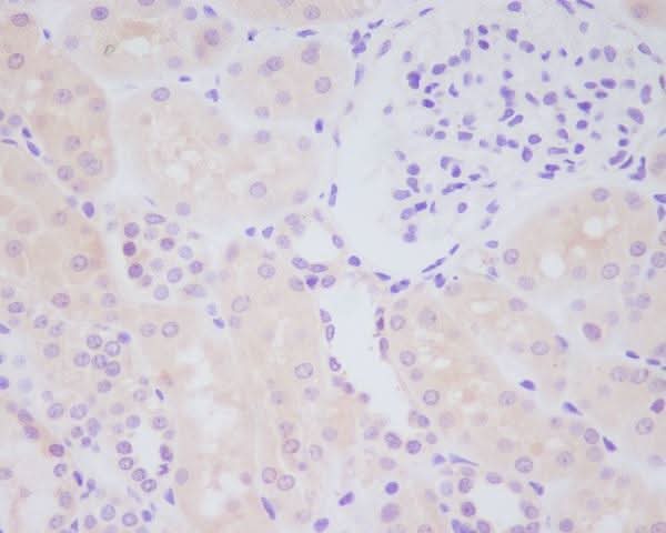 Anti-MMP14/Mt1 Mmp Rabbit Monoclonal Antibody Boster Bio