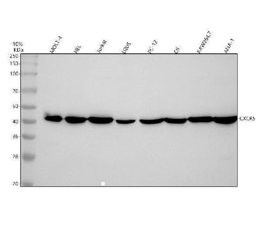 Anti-CXCR5 Rabbit Monoclonal Antibody Boster Bio