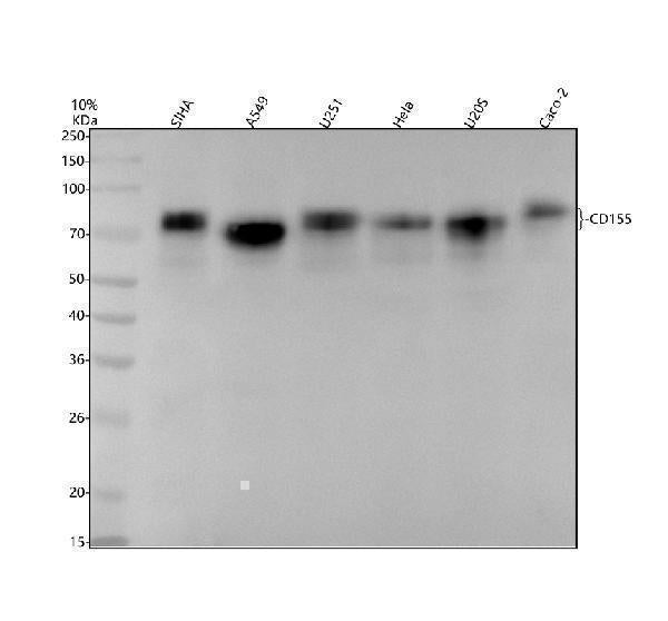 Anti-Poliovirus Receptor Rabbit Monoclonal Antibody Boster Bio
