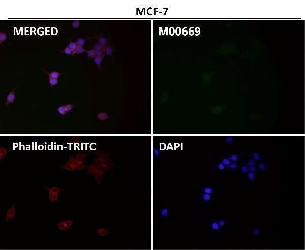 Anti-PAX5/Bsap Rabbit Monoclonal Antibody Boster Bio