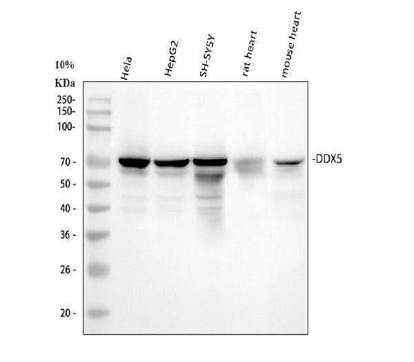 Anti-DDX5 Monoclonal Antibody Boster Bio