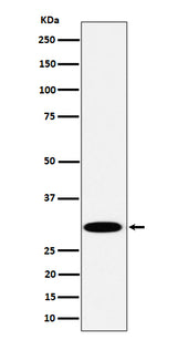 Anti-TPMT Rabbit Monoclonal Antibody Boster Bio
