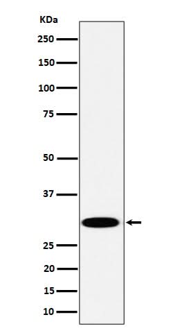 Anti-TPMT Rabbit Monoclonal Antibody Boster Bio