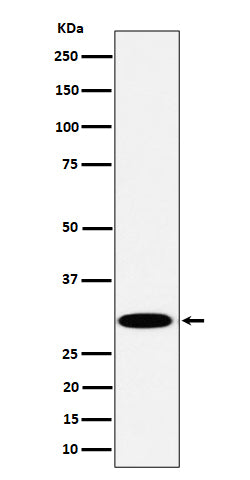 Anti-TPMT Rabbit Monoclonal Antibody Boster Bio