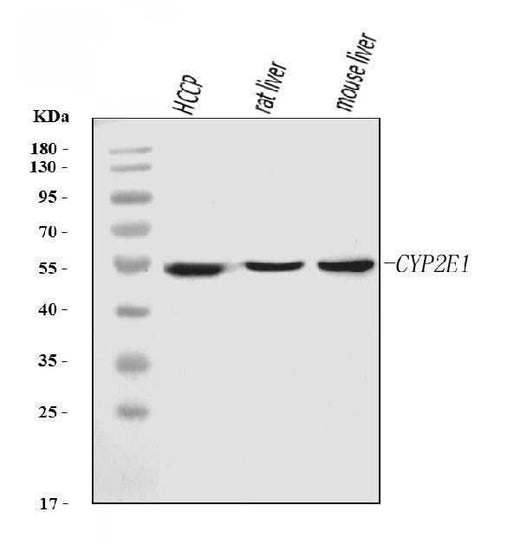 Anti-Cytochrome P450 2E1/CYP2E1 Antibody Picoband® (monoclonal, 2C7G1 Boster Bio