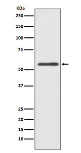 Anti-CYP2E1 Rabbit Monoclonal Antibody Boster Bio