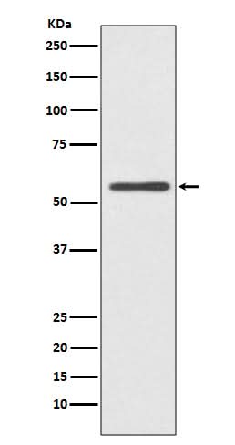 Anti-CYP2E1 Rabbit Monoclonal Antibody Boster Bio