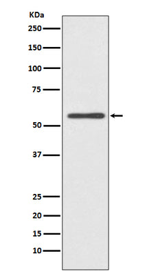 Anti-CYP2E1 Rabbit Monoclonal Antibody Boster Bio