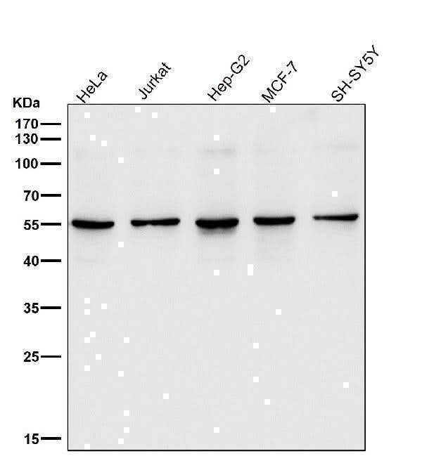 Anti-SGK1/Sgk Rabbit Monoclonal Antibody Boster Bio