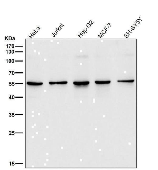 Anti-SGK1/Sgk Rabbit Monoclonal Antibody Boster Bio
