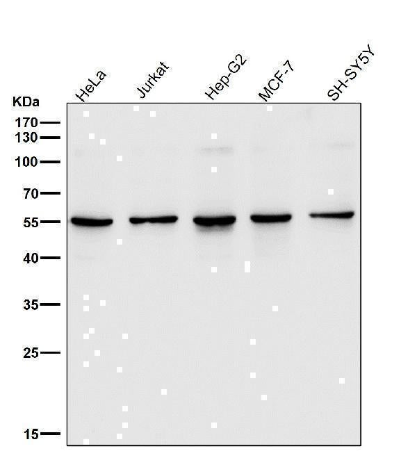 Anti-SGK1/Sgk Rabbit Monoclonal Antibody Boster Bio