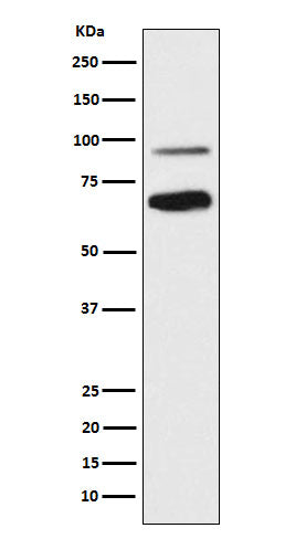 Anti-TCF4 Rabbit Monoclonal Antibody Boster Bio