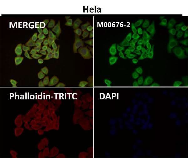 Anti-Hsp27 HSPB1 Rabbit Monoclonal Antibody Boster Bio