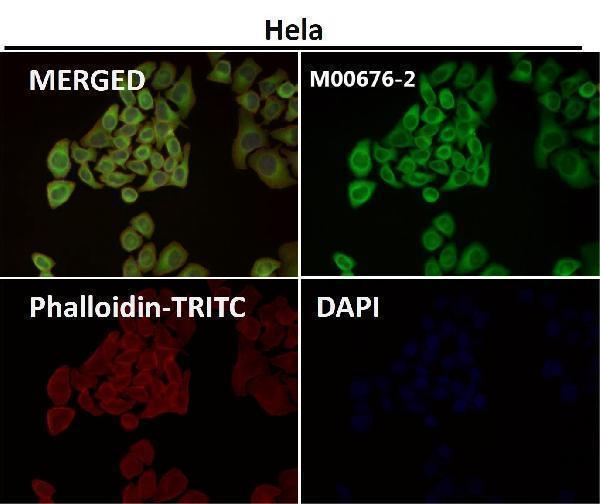 Anti-Hsp27 HSPB1 Rabbit Monoclonal Antibody Boster Bio