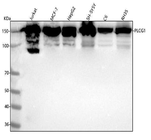 Anti-PLCG1/Plc Gamma 1 Rabbit Monoclonal Antibody Boster Bio