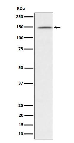 Anti-phospho-Phospholipase C gamma 1/PLC-gamma-1 (Y1253) Rabbit Monoclonal Antibody Boster Bio