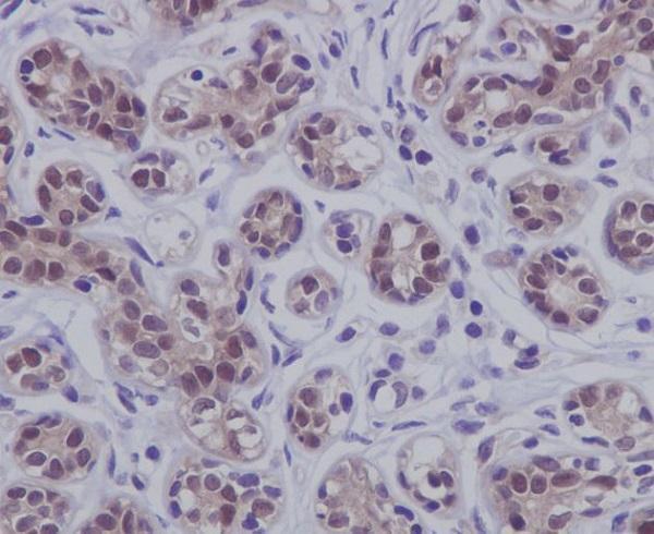 Anti-STAT5b Rabbit Monoclonal Antibody Boster Bio