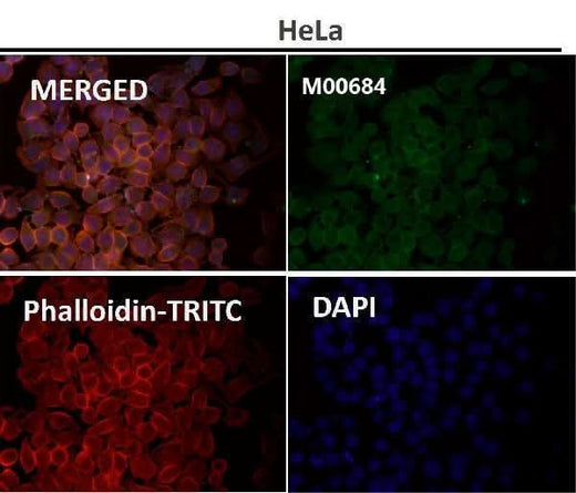 Anti-Fyn Rabbit Monoclonal Antibody Boster Bio