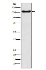Anti-ATP7b Rabbit Monoclonal Antibody Boster Bio
