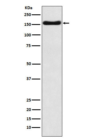 Anti-ATP7b Rabbit Monoclonal Antibody Boster Bio