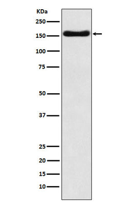 Anti-ATP7b Rabbit Monoclonal Antibody Boster Bio