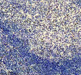 Anti-Egr1 Monoclonal Antibody Boster Bio