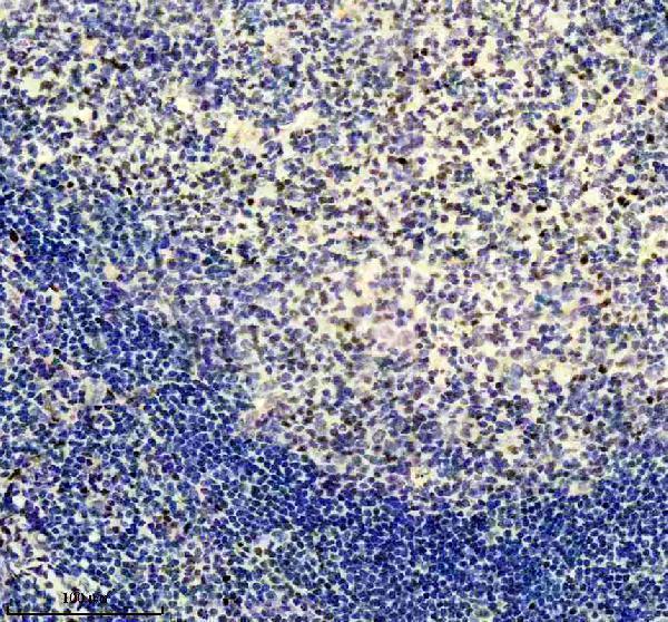 Anti-Egr1 Monoclonal Antibody Boster Bio