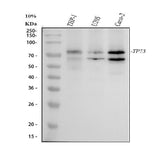 Anti-p73 Rabbit Monoclonal Antibody Boster Bio