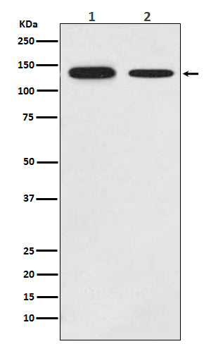 Anti-Growth hormone receptor Rabbit Monoclonal Antibody Boster Bio