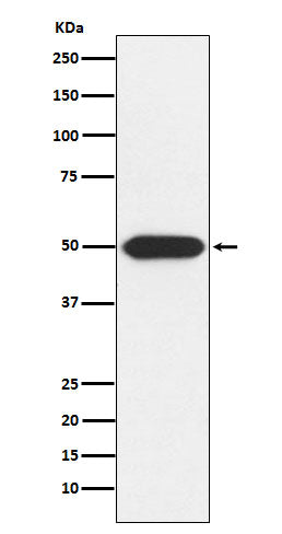 Anti-PRKAR1A Rabbit Monoclonal Antibody Boster Bio