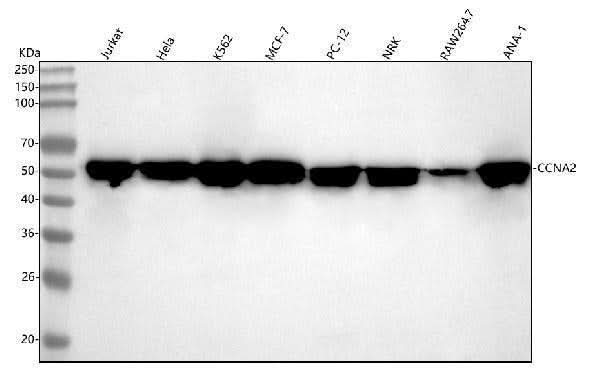 Anti-Cyclin A2 Rabbit Monoclonal Antibody Boster Bio