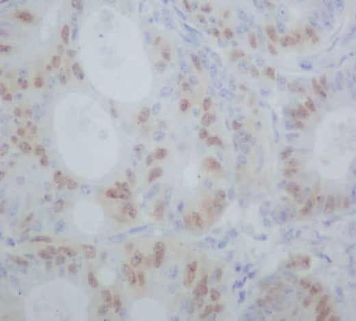 Anti-Cyclin A1/A2 Rabbit Monoclonal Antibody Boster Bio