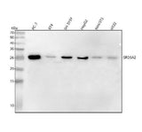 Anti-SRD5A2 Rabbit Monoclonal Antibody Boster Bio