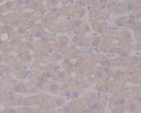 Anti-TrkA NTRK1 Rabbit Monoclonal Antibody Boster Bio