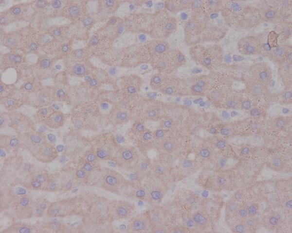 Anti-TrkA NTRK1 Rabbit Monoclonal Antibody Boster Bio
