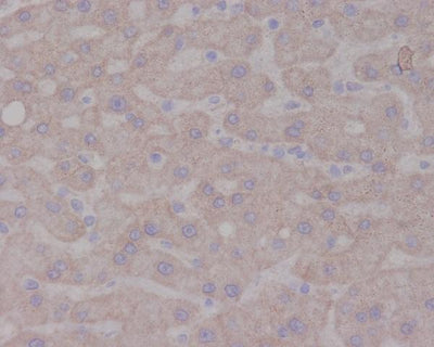 Anti-TrkA NTRK1 Rabbit Monoclonal Antibody Boster Bio