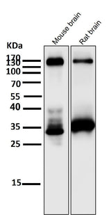 Anti-TrkA+B+C NTRK1 Rabbit Monoclonal Antibody Boster Bio