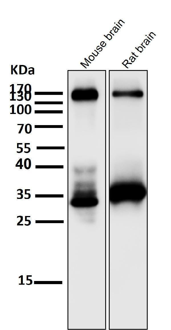 Anti-TrkA+B+C NTRK1 Rabbit Monoclonal Antibody Boster Bio